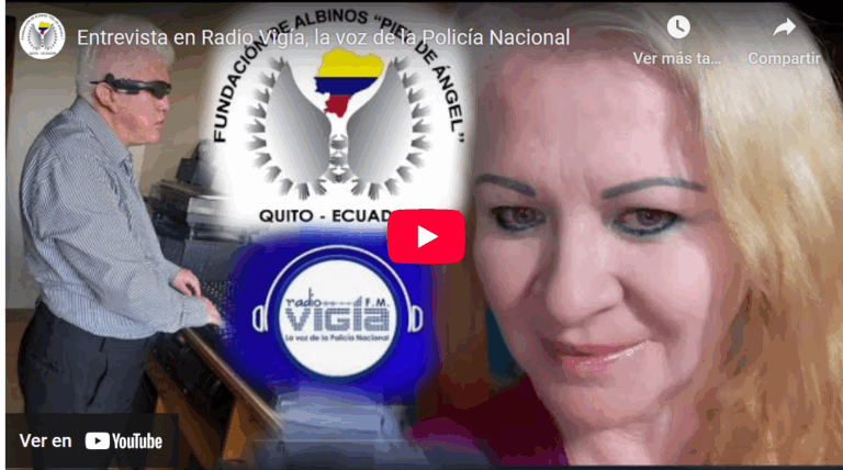 Personaje de la Semana: Rhyna Mely Rivera Sánchez, una voz por la visibilidad y los derechos de las personas con albinismo.
